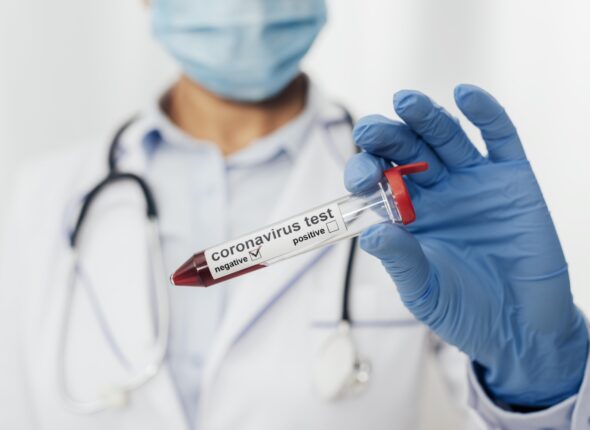 close-up-doctor-holding-coronavirus-test